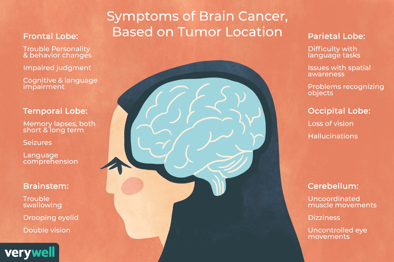 Farringdon Parish Council Hampshire Brain Cancer - Symptoms